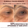 DARK SPOT CORRECTING RADIANCE RECOVERY SERUM 10 ML