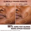 DARK SPOT CORRECTING RADIANCE RECOVERY SERUM 10 ML