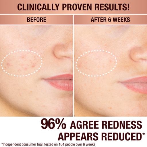 DARK SPOT CORRECTING RADIANCE RECOVERY SERUM 10 ML